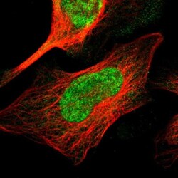 TMEM65 Antibody, Novus Biologicals 0.1mL; Unlabeled:Antibodies, Polyclonal